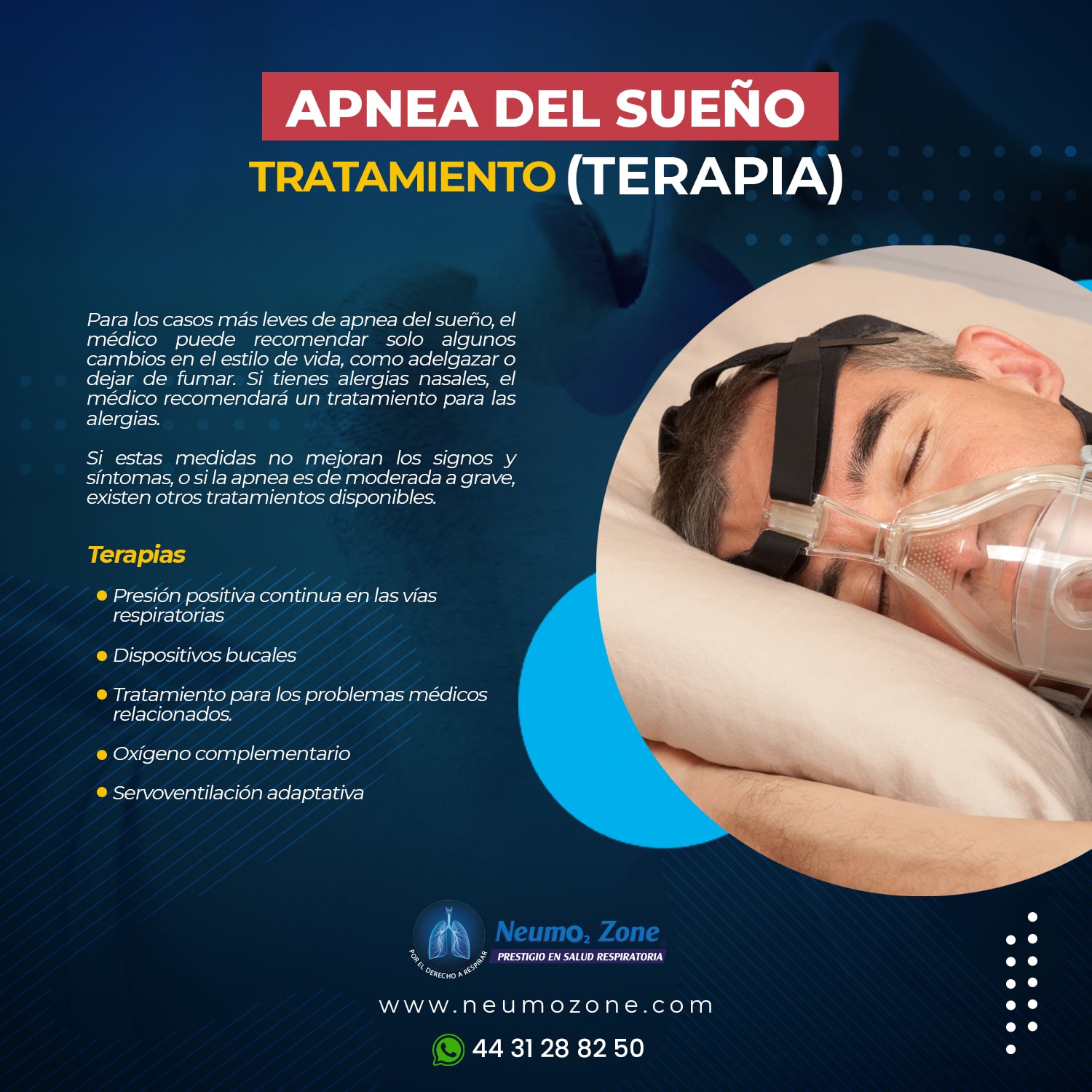 Apnea Del Sueño Tipos Síntomas Causas Factores De Riesgo 8245